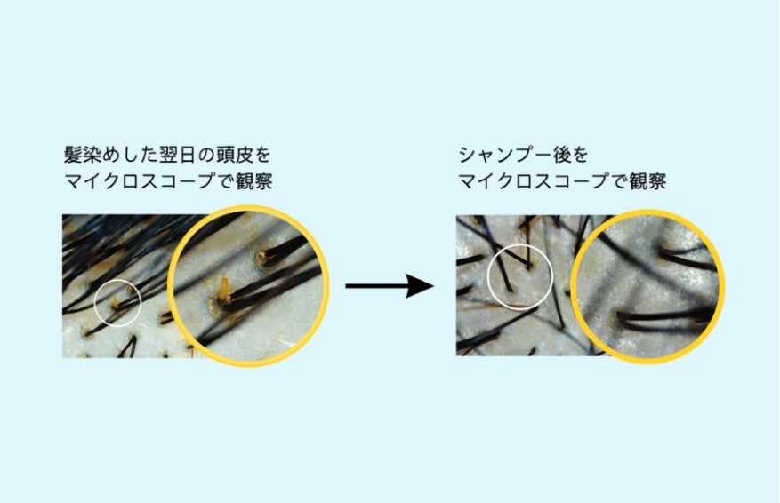 髪のコンディション改善